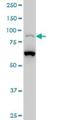 Lysine Acetyltransferase 2B antibody, H00008850-M02, Novus Biologicals, Western Blot image 