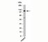 CYLD Lysine 63 Deubiquitinase antibody, N1164-100UG, NSJ Bioreagents, Western Blot image 