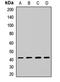 N-Myc Downstream Regulated 1 antibody, LS-C668688, Lifespan Biosciences, Western Blot image 