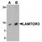 Late Endosomal/Lysosomal Adaptor, MAPK And MTOR Activator 3 antibody, MBS153465, MyBioSource, Western Blot image 