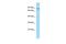 Centrosomal Protein 63 antibody, PA5-45893, Invitrogen Antibodies, Western Blot image 