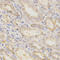 Golgi Associated, Gamma Adaptin Ear Containing, ARF Binding Protein 2 antibody, LS-C331330, Lifespan Biosciences, Immunohistochemistry paraffin image 