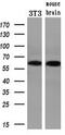 Checkpoint Kinase 2 antibody, M00277-2, Boster Biological Technology, Western Blot image 