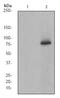 Bruton Tyrosine Kinase antibody, ab68217, Abcam, Western Blot image 