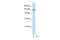 Timeless Circadian Regulator antibody, 28-863, ProSci, Western Blot image 