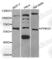Protein Phosphatase, Mg2+/Mn2+ Dependent 1D antibody, A6204, ABclonal Technology, Western Blot image 