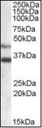 Arylsulfatase B antibody, orb88114, Biorbyt, Western Blot image 