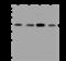Proteasome 26S Subunit, Non-ATPase 7 antibody, 200802-T44, Sino Biological, Western Blot image 