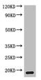 Mitochondrial Inner Membrane Protein MPV17 antibody, A57269-100, Epigentek, Western Blot image 