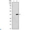 ATM Serine/Threonine Kinase antibody, LS-C813987, Lifespan Biosciences, Western Blot image 