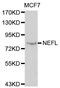 Neurofilament Light antibody, MBS125939, MyBioSource, Western Blot image 