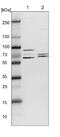 T-Complex 1 antibody, NBP1-88148, Novus Biologicals, Western Blot image 