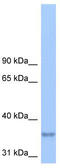 Phospholipid Phosphatase Related 2 antibody, TA338613, Origene, Western Blot image 