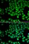 Transient Receptor Potential Cation Channel Subfamily M Member 2 antibody, orb373346, Biorbyt, Immunofluorescence image 