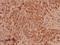 Claudin 7 antibody, A03851-1, Boster Biological Technology, Immunohistochemistry paraffin image 