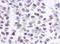 Casein Kinase 2 Alpha 1 antibody, H00001457-M01, Novus Biologicals, Western Blot image 
