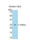 Ubiquitin C-Terminal Hydrolase L5 antibody, LS-C296905, Lifespan Biosciences, Western Blot image 