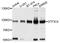 General Transcription Factor IIIC Subunit 4 antibody, A12724, Boster Biological Technology, Western Blot image 