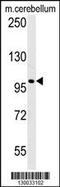 Enhancer Of Polycomb Homolog 2 antibody, 61-836, ProSci, Western Blot image 