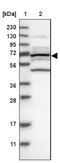 Plastin 3 antibody, NBP2-13778, Novus Biologicals, Western Blot image 