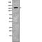 Alpha-2-Macroglobulin antibody, abx146534, Abbexa, Western Blot image 