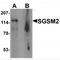 Small G Protein Signaling Modulator 2 antibody, MBS151080, MyBioSource, Western Blot image 