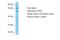 Rab Geranylgeranyltransferase Subunit Alpha antibody, A30213, Boster Biological Technology, Western Blot image 