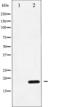 Protein Phosphatase 1 Regulatory Inhibitor Subunit 14A antibody, TA326035, Origene, Western Blot image 