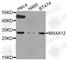 Membrane Spanning 4-Domains A12 antibody, A8223, ABclonal Technology, Western Blot image 