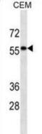 Desmin antibody, abx025293, Abbexa, Western Blot image 