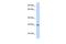 Adenosine Deaminase Like antibody, PA5-43731, Invitrogen Antibodies, Western Blot image 