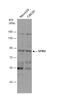 G Elongation Factor Mitochondrial 2 antibody, NBP2-16646, Novus Biologicals, Western Blot image 