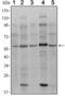 SMAD Family Member 4 antibody, GTX82787, GeneTex, Western Blot image 