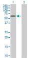 Tubulointerstitial Nephritis Antigen antibody, H00027283-B01P, Novus Biologicals, Western Blot image 