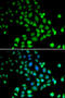 Poly(A)-Specific Ribonuclease antibody, 19-242, ProSci, Immunofluorescence image 