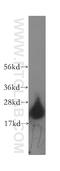 Hippocalcin Like 4 antibody, 12470-1-AP, Proteintech Group, Western Blot image 