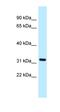 ALG5 Dolichyl-Phosphate Beta-Glucosyltransferase antibody, orb326404, Biorbyt, Western Blot image 
