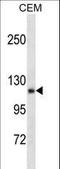 Angiomotin antibody, LS-C161056, Lifespan Biosciences, Western Blot image 