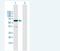 Protein Phosphatase 2 Regulatory Subunit B'Beta antibody, H00005526-B01P-50ug, Novus Biologicals, Western Blot image 