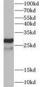 Baculoviral IAP Repeat Containing 8 antibody, FNab00901, FineTest, Western Blot image 