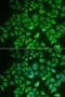 Enoyl-CoA Hydratase And 3-Hydroxyacyl CoA Dehydrogenase antibody, LS-C334238, Lifespan Biosciences, Immunofluorescence image 