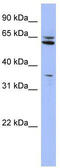 Prolyl 4-Hydroxylase, Transmembrane antibody, TA344618, Origene, Western Blot image 