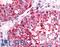 Ubiquitin C-Terminal Hydrolase L3 antibody, LS-A8555, Lifespan Biosciences, Immunohistochemistry paraffin image 