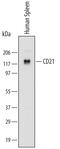 Complement C3d Receptor 2 antibody, MAB4909, R&D Systems, Western Blot image 