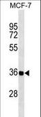 RAS Like Family 12 antibody, LS-C158807, Lifespan Biosciences, Western Blot image 