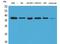 Ribosomal RNA-processing protein 7 homolog A antibody, A15583, Boster Biological Technology, Western Blot image 