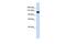 UPF1 RNA Helicase And ATPase antibody, PA5-41262, Invitrogen Antibodies, Western Blot image 