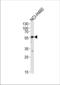 Gamma-Aminobutyric Acid Type A Receptor Alpha2 Subunit antibody, TA325099, Origene, Western Blot image 