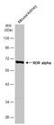 RAR Related Orphan Receptor A antibody, GTX108201, GeneTex, Western Blot image 