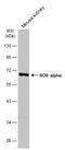 Nuclear receptor ROR-alpha antibody, GTX108201, GeneTex, Western Blot image 